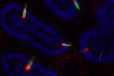 Hormone cells are interspersed throughout other intestinal cells